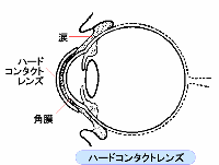 n[hR^NgỸC[W}